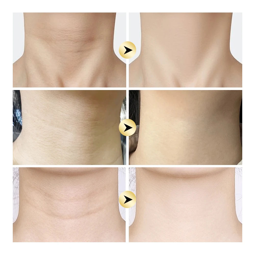 AH-8 Neck Firming Cream with Roller Massager